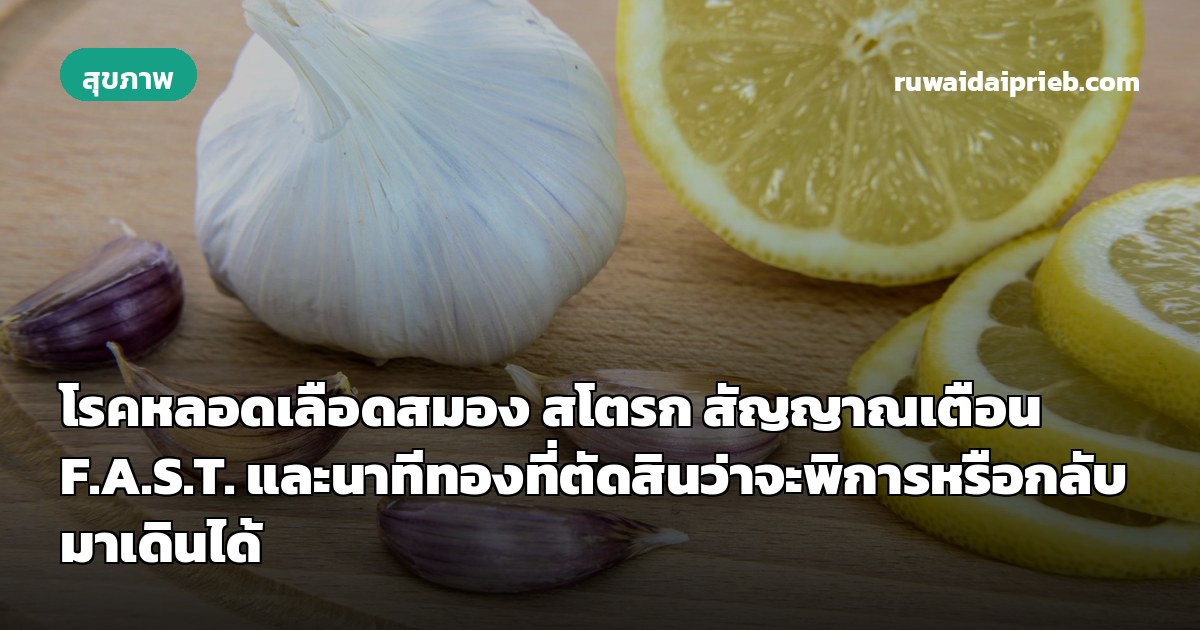 โรคหลอดเลือดสมอง สโตรก สัญญาณเตือน F.A.S.T. และนาทีทองที่ตัดสินว่าจะพิการหรือกลับมาเดินได้